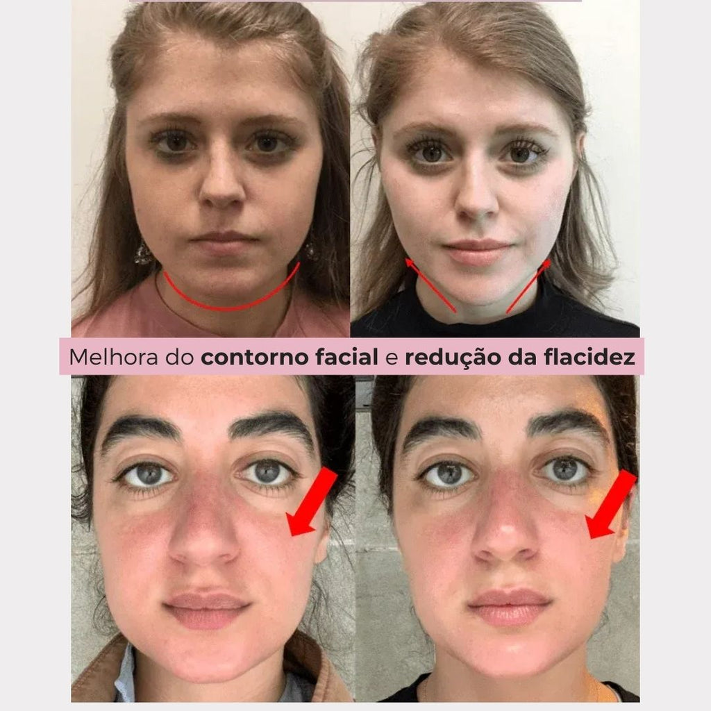 V- LiftUp - Máscara Coreana - Levanta o rosto, suaviza rugas e reduz papada [PROMO DE LANÇAMENTO]